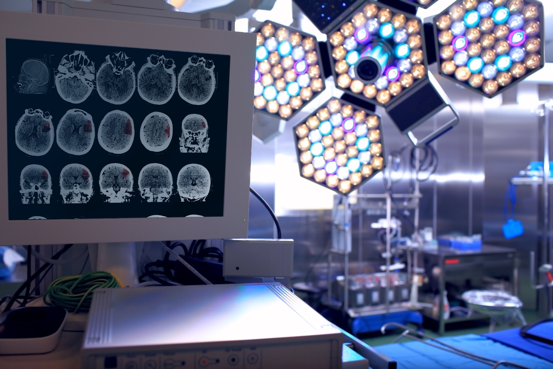 Best Neurosurgery in the Costa del Sol